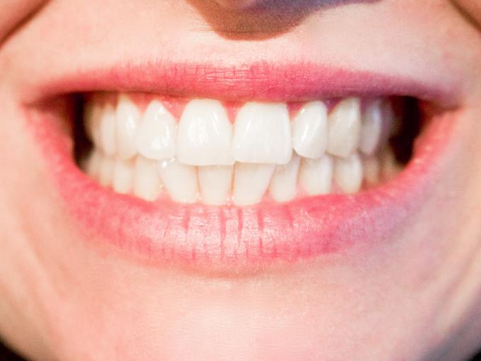 ukázka úsměvu s bílými zuby